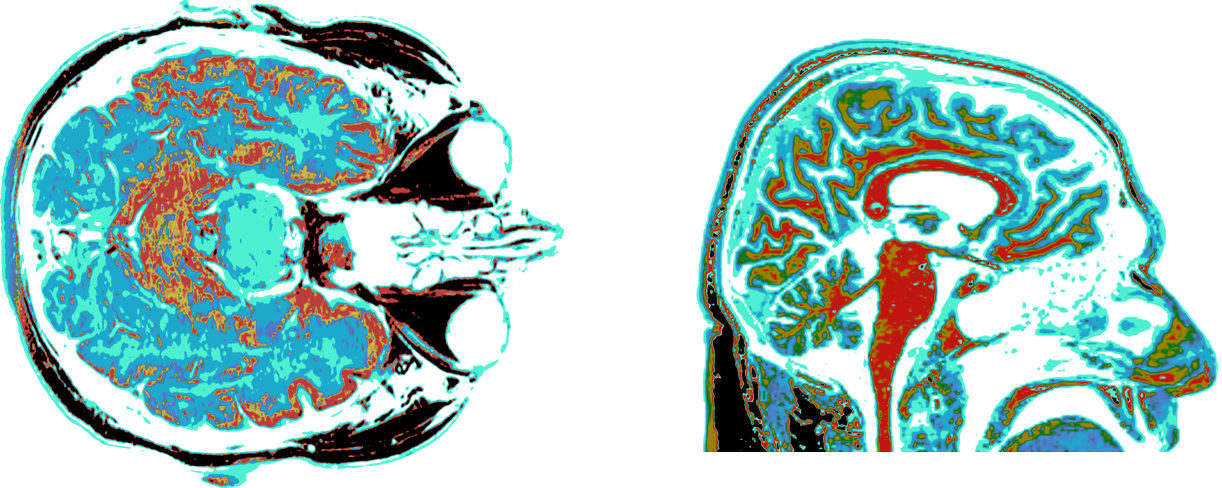 What If We Had Bigger Brains?